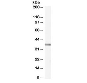 Western blot testing of rat spleen lysate with Ogg1 antibody at 0.1ug/ml. Predicted molecular weight ~38kDa.~