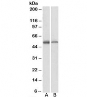 Western blot testing of A) human and B) mouse thymus lysate with ETEA antibody at 1ug/ml. Predicted molecular weight: ~53kDa.