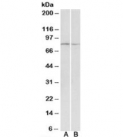 Western blot of mouse and rat skeletal muscle lysate with DAG antibody at 0.1ug/ml. Predicted molecular weight: ~97kDa, observed here at ~80kDa.