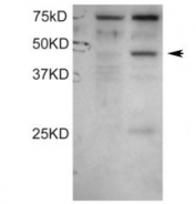 Western blot testing of COS1 cell lysates: untransfected (left lane) and transfected with full length human DYX1C1 (right lane).  DYX1C1 antibody was used at 0.1ug/ml. Predicted molecular weight: ~48kDa.