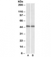 Western blot of mouse (A) and rat (B) liver lysates with IDH1 antibody at 0.1ug/ml. Predicted molecular weight ~46 kDa.