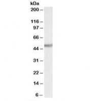 Western blot testing of rat kidney lysate with Ugt2b antibody at 0.1ug/ml. Predicted molecular weight: ~61kDa, observed here at ~50kDa.