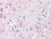 IHC testting of FFPE human brain cortex with DTX3 antibody at 10ug/ml. Required HIER: steamed antigen retrieval with pH6 citrate buffer; AP-staining.