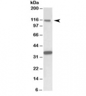 Western blot testing of human hippocampus lysate with KIT antibody at 1ug/ml. Observed molecular weight: ~120/145kDa (precusor/mature).