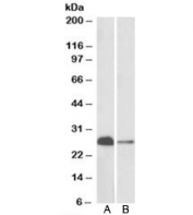 Western blot of mouse (A) and rat (B) brain lysates with Calbindin 1 antibody at 0.1ug/ml. Predicted molecular weight: ~30 kDa, routinely observed at 27-28 kDa.