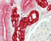 IHC staining of FFPE human kidney with Calbindin 1 antibody at 5ug/ml. HIER: boil tissue sections in pH6, 10mM citrate buffer, for 10-20 min and allow to cool before testing.