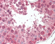 IHC testing of FFPE human testis tissue with COG7 antibody at 5ug/ml. Required HIER: steamed antigen retrieval with pH6 citrate buffer; AP-staining.