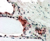IHC testing of FFPE human thyroid gland with COPS2 antibody at 3ug/ml shows nclear and cytoplasm staining in activated epithelial cells.
