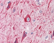 IHC testing of FFPE human brain tissue (cortex) with PRDM11 antibody at 5ug/ml. Required HIER: steamed antigen retrieval with pH6 citrate buffer; AP-staining.