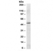 Western blot testing of A549 lysate with PRDM11 antibody at 2ug/ml. Predicted molecular weight: ~58/54 kDa (isoforms 1/2).