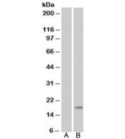 Western blot of HEK293 lysate overexpressing PLA2G1B probed with PLA2G1B antibody (mock transfection in lane 1). Predicted molecular weight: ~16kDa.