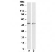 Western blot testing of human A) lung and B) umbical cord lysates with ECSM2 antibody at 1ug/ml. Predicted molecular weight: ~21/40-60 kDa (unmodified/glycosylated).