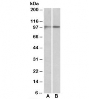 Western blot testing of A549 (A) and Jurkat (B) lysates with HIC1 antibody at 1ug/ml. Western blot of HEK293 lysate overexpressing human HIC1 tested with HIC1 antibody at (0.5ug/ml). Mock transfection lanes also shown. Predicted molecular weight: ~77kDa but can be observed at ~100kDa.