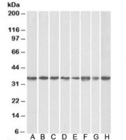 Western blot of mouse NIH3T3 (A),  and human HEK293 (B), HeLa (C), A431 (D), A549 (E), MCF7 (F), Jurkat (G), K562 (H) lysates with GNB2L1 antibody at 0.1ug/ml. Predicted molecular weight: ~35kDa.