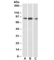 Western blot testing of human frontal cortex [A], mouse [B] and rat [C] brain lysate with ELMO1 antibody at 0.3ug/ml. Predicted molecular weight: ~84kDa.