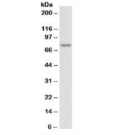 Western blot testing of Jurkat nuclear lysate with TDP1 antibody at 2ug/ml. Predicted molecular weight: ~68kDa.