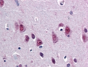 IHC testing of FFPE human brain cortex tissue with SMUG1 antibody at 5ug/ml. Required HIER: steamed antigen retrieval with pH6 citrate buffer; AP-staining.