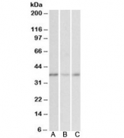 Western blot testing of human cerebellum (A), duodenum (B) and heart (C) lysates with MICS1 antibody at 0.01ug/ml. Predicted molecular weight: ~38 kDa.