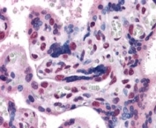 IHC staining of FFPE human placenta with GBX2 antibody at 3.8ug/ml. HIER: steamed with pH6 citrate buffer, AP-staining. Nuclear staining of trophoblasts is seen.