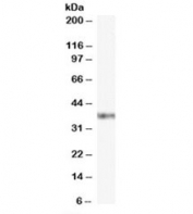 Western blot testing of Jurkat cell lysate with GBX2 antibody at 0.1ug/ml. Predicted molecular weight ~37kDa.