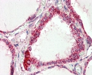 IHC staining of FFPE human thyroid gland with COX4I1 antibody at 2.5ug/ml. HIER: steamed with pH6 citrate buffer, AP-st