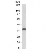 Western blot testing of HEK293 lysate with CBR3 antibody at 0.5ug/ml. Predicted molecular weight: ~31kDa, observed size ~35kDa.