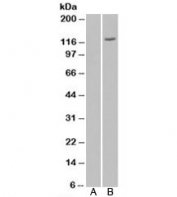 Western blot of HEK293 lysate overexpressing FAM62A probed with FAM62A antibody (mock transfection in lane 1). Predicted molecular weight: ~123 kDa.