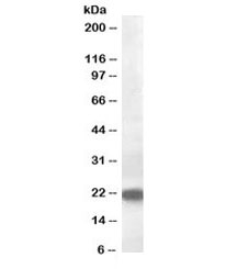 Western blot testing of human liver lysate with VPS25 antibody at 0.5ug/ml. Predicted molecular weight: ~21kDa.~