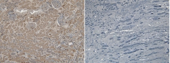 IHC staining of FFPE human kidney tissue with (left) and without (right) VPS25 antibody at 6ug/ml. Required HIER: steamed