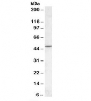 Western blot testing of human cerebellum lysate with CHRNB2 antibody at 1ug/ml. Predicted molecular weight: ~57 kDa but can be observed at ~50 kDa.