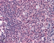 IHC staining of FFPE human spleen with CARD11 antibody at 2ug/ml. HIER: steamed with pH6 citrate buffer, AP-staining.