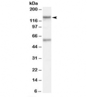 Western blot testing of human Jurkat lysate and CARD11 antibody at 1ug/ml. The expected ~133 kDa band and additional ~60 kDa band are both blocked by the immunizing peptide.
