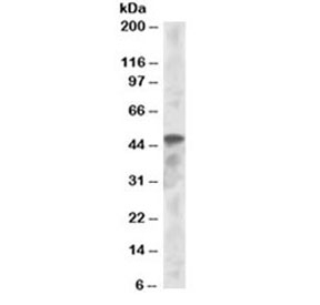 Western blot testing of K562 lysate with IRF8 antibody at 1ug/ml. Predicted molecular weight ~48kDa.~