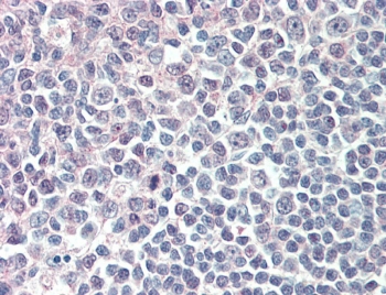 IHC testing of FFPE human tonsil tissue with IRF8 antibody at 5ug/ml. Steamed antigen retrieval with citrate buffer pH 6, AP-staining