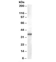 Western blot testing of A549 cell lysate with AKR1B10 antibody at 0.03ug/ml. Predicted molecular weight: ~36kDa.~
