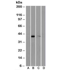 Western blot of HEK293 lysate overexpressing AKR1B10-FLAG tag probed with B) anti-FLAG in the left panel and with C) AKR1
