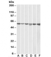 Western blot testing of HeLa (A), A431 (B), A549 (C), MCF7 (D), Jurkat (E) and K562 (F) lysates with GPI antibody at 0.05ug/ml. Predicted molecular weight ~63 kDa, observed here at ~55 kDa.