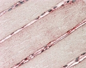 IHC staining of FFPE human skeletal muscle with delta-Sarcoglycan antibody at 3.8ug/ml. HIER: steamed with pH6 citrate buffer, AP-staining. Sarcolemmar staining of the fibers is seen.