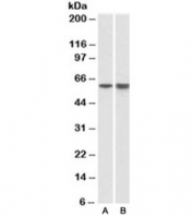 Western blot of pig bone marrow (A) and spleen (B) lysates with LCK antibody at 1ug/ml. Predicted molecular weight ~58 kDa.