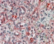 IHC staining of FFPE human spleen with TMX1 antibody at 4ug/ml. HIER: steamed with pH6 citrate buffer, AP-staining.