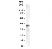 Western blot testing of human liver lysate with GOT1 antibody at 0.01ug/ml. Predicted molecular weight 46 kDa but routinely observed from 40~46 kDa.