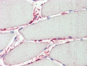 IHC testing of FFPE human skeletal muscle tissue with Peptidase inhibitor 15 antibody at 5ug/ml. Required HIER: steamed antigen retrieval with pH6 citrate buffer; AP-staining.