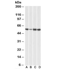 Western blot testing of human [A], fetal mouse [B], adult mouse [C] and adult rat [D] heart lysates with ATP5A1 antibody at 0.01ug/ml. Predicted molecular weight: ~55kDa.~