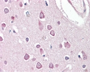 IHC testing of FFPE human brain (cortex) tissue with HAP1 antibody at 3.75ug/ml. Required HIER: steamed antigen retrieval with pH6 citrate buffer; AP-staining.