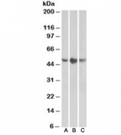 Western blot testing of A549 (A), HepG2 (B) and K562 (C) lysates with TNFR1 antibody at 0.5ug/ml. Predicted molecular weight ~51kDa.