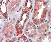 IHC staining of FFPE human kidney with IRP2 antibody at 4ug/ml. HIER: steamed with pH6 citrate buffer, AP-staining.