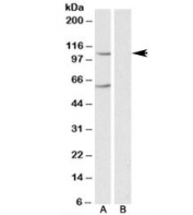 Western blot testing of human liver lysate with IRP2 antibody at 0.3ug/ml in the A) absence and B) presence of immunizing peptide. Predicted molecular weight ~105kDa. The ~60kDa band is likely a breakdown product of the protein.