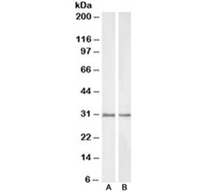 Western blot of rat (A) and pig (B) kidney lysate with NQO1 antibody at 1ug/ml. Predicted molecular weight ~30kDa.