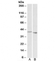 Western blot of rat A) spleen and B) thymus lysate with PCBP1 antibody at 0.1ug/ml. Predicted/observed molecular weight: ~38kDa.