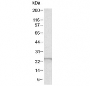 Western blot testing of human liver lysate with Glutathione peroxidase 2 antibody at 0.5ug/ml. Predicted molecular weight ~22kDa.